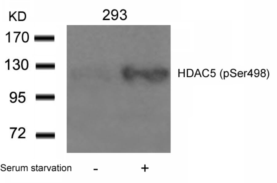 Western blot - HDAC5 (Phospho-Ser498) Antibody from Signalway Antibody (11193) - Antibodies.com