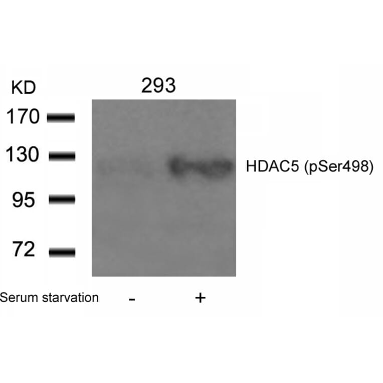 Western blot - HDAC5 (Phospho-Ser498) Antibody from Signalway Antibody (11193) - Antibodies.com