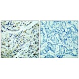Immunohistochemistry - HDAC5 (Phospho-Ser498) Antibody from Signalway Antibody (11193) - Antibodies.com