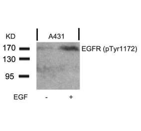 Western blot - EGFR (Phospho-Tyr1172) Antibody from Signalway Antibody (11220) - Antibodies.com