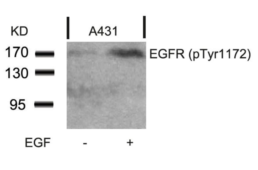Western blot - EGFR (Phospho-Tyr1172) Antibody from Signalway Antibody (11220) - Antibodies.com