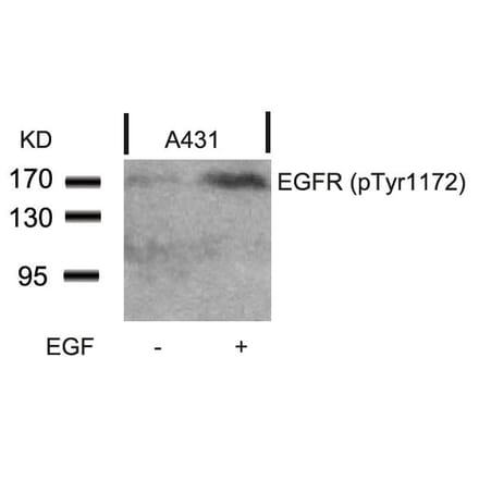 Western blot - EGFR (Phospho-Tyr1172) Antibody from Signalway Antibody (11220) - Antibodies.com