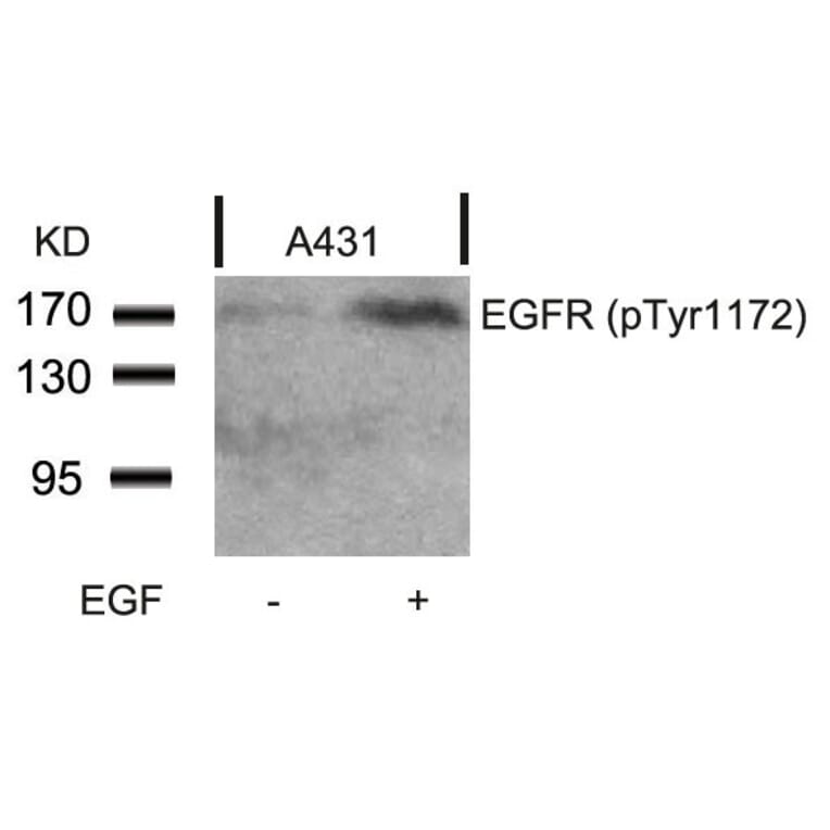 Western blot - EGFR (Phospho-Tyr1172) Antibody from Signalway Antibody (11220) - Antibodies.com