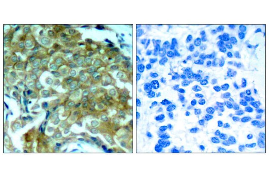 Immunohistochemistry - EGFR (Phospho-Tyr1172) Antibody from Signalway Antibody (11220) - Antibodies.com