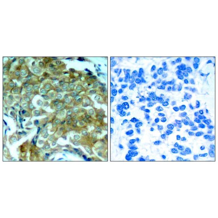 Immunohistochemistry - EGFR (Phospho-Tyr1172) Antibody from Signalway Antibody (11220) - Antibodies.com