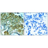 Immunohistochemistry - EGFR (Phospho-Tyr1172) Antibody from Signalway Antibody (11220) - Antibodies.com