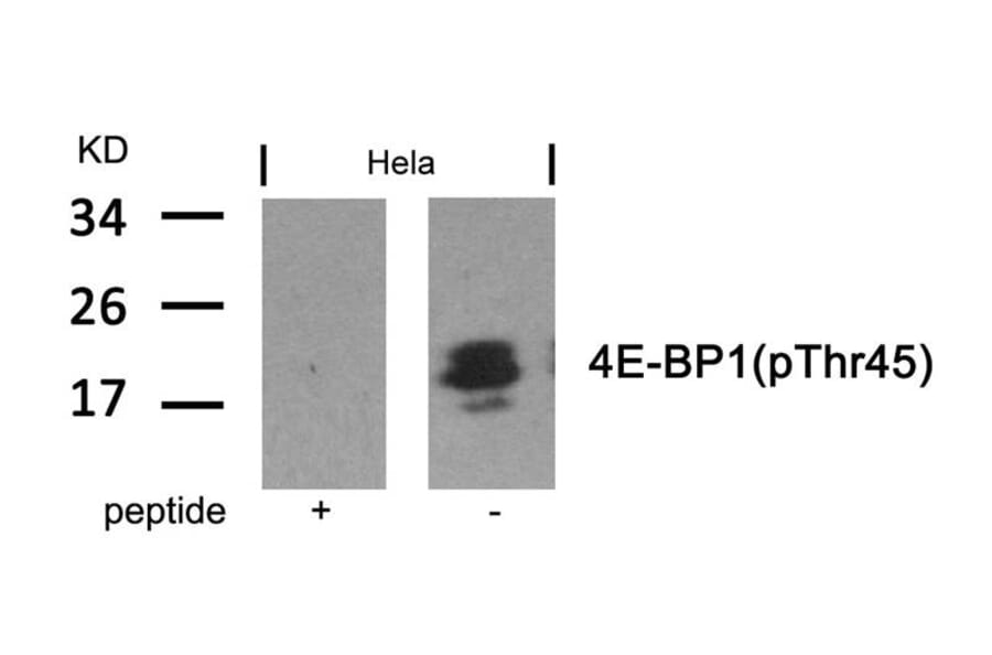 Western blot - 4E-BP1 (Phospho-Thr46) Antibody from Signalway Antibody (11223) - Antibodies.com