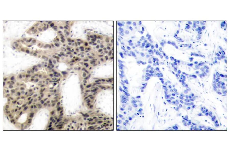 Immunohistochemistry - 4E-BP1 (Phospho-Thr46) Antibody from Signalway Antibody (11223) - Antibodies.com