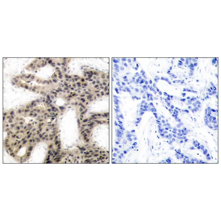 Immunohistochemistry - 4E-BP1 (Phospho-Thr46) Antibody from Signalway Antibody (11223) - Antibodies.com