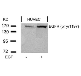 Western blot - EGFR (Phospho-Tyr1197) Antibody from Signalway Antibody (11228) - Antibodies.com