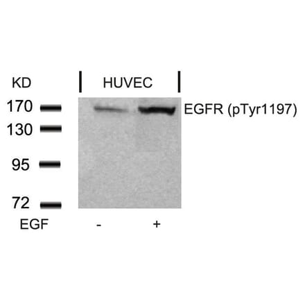 Western blot - EGFR (Phospho-Tyr1197) Antibody from Signalway Antibody (11228) - Antibodies.com