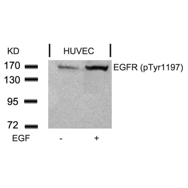 Western blot - EGFR (Phospho-Tyr1197) Antibody from Signalway Antibody (11228) - Antibodies.com