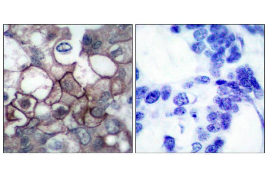 Immunohistochemistry - EGFR (Phospho-Tyr1197) Antibody from Signalway Antibody (11228) - Antibodies.com