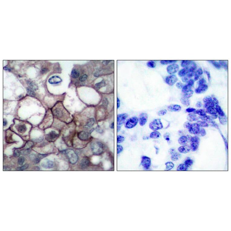 Immunohistochemistry - EGFR (Phospho-Tyr1197) Antibody from Signalway Antibody (11228) - Antibodies.com
