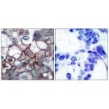 Immunohistochemistry - EGFR (Phospho-Tyr1197) Antibody from Signalway Antibody (11228) - Antibodies.com
