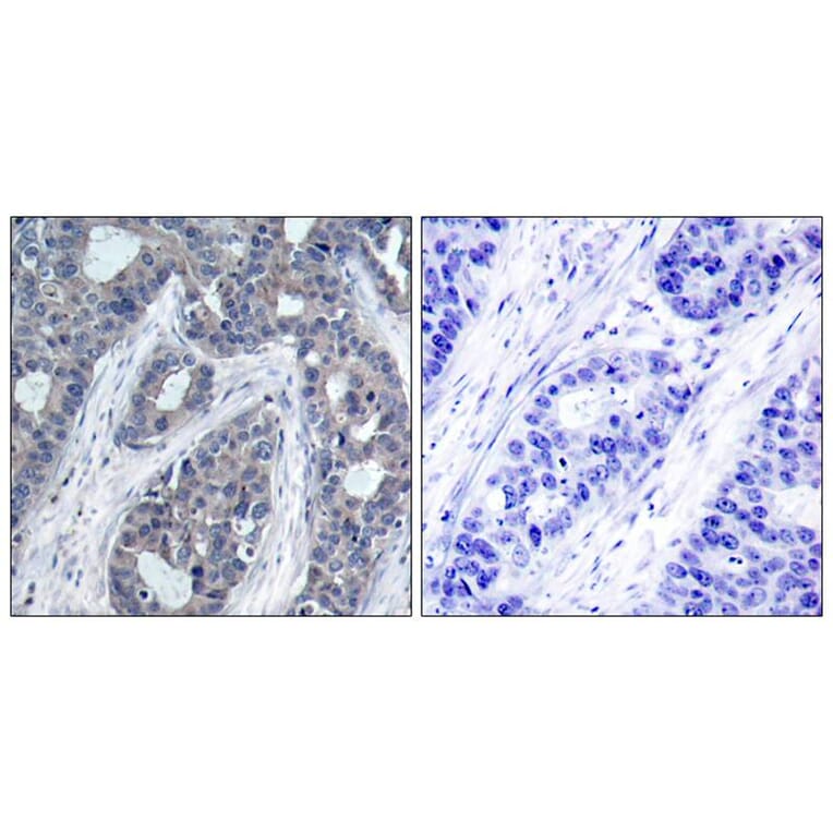 Immunohistochemistry - IRS-1 (Phospho-Ser636) Antibody from Signalway Antibody (11230) - Antibodies.com