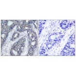 Immunohistochemistry - IRS-1 (Phospho-Ser636) Antibody from Signalway Antibody (11230) - Antibodies.com