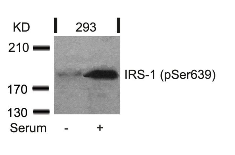 Western blot - IRS-1 (Phospho-Ser639) Antibody from Signalway Antibody (11231) - Antibodies.com