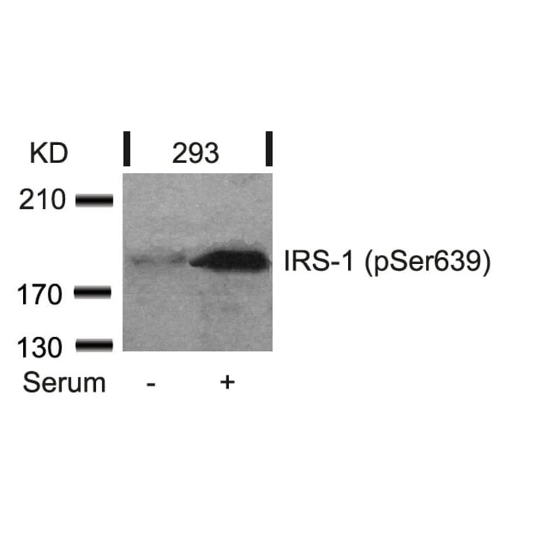 Western blot - IRS-1 (Phospho-Ser639) Antibody from Signalway Antibody (11231) - Antibodies.com