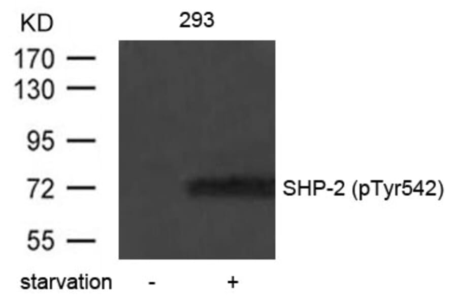 Western blot - SHP-2 (Phospho-Tyr542) Antibody from Signalway Antibody (11319) - Antibodies.com
