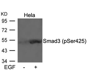Western blot - Smad3 (Phospho-Ser425) Antibody from Signalway Antibody (11325) - Antibodies.com