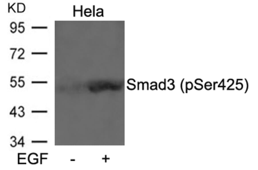 Western blot - Smad3 (Phospho-Ser425) Antibody from Signalway Antibody (11325) - Antibodies.com