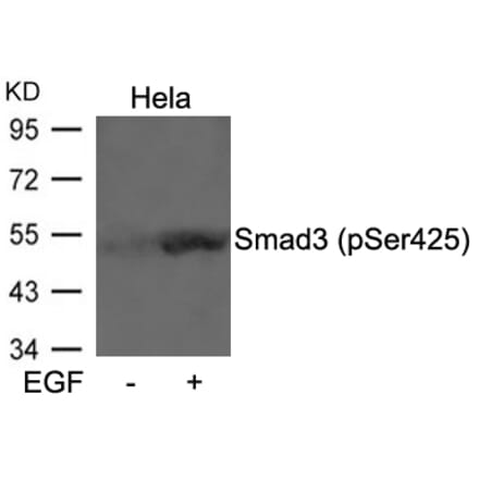 Western blot - Smad3 (Phospho-Ser425) Antibody from Signalway Antibody (11325) - Antibodies.com