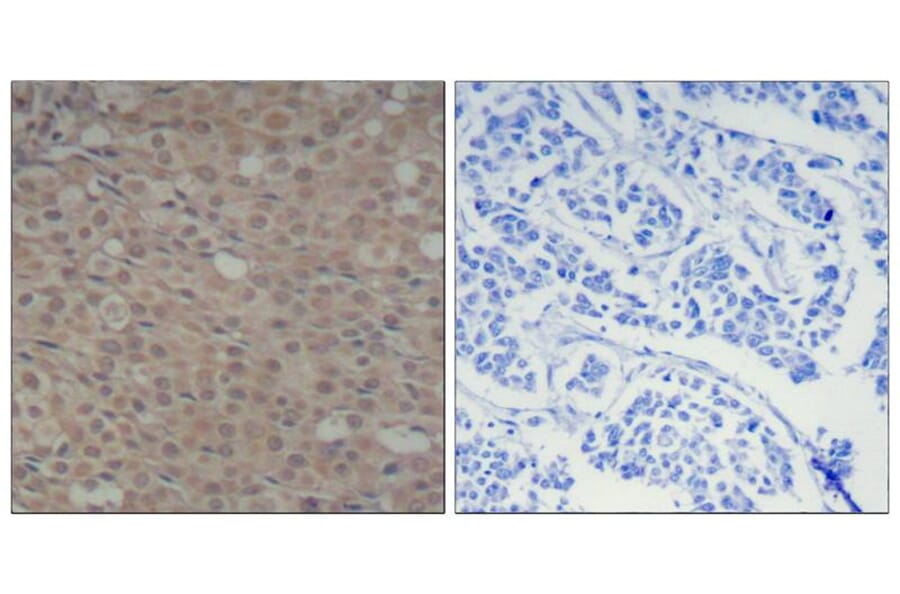 Immunohistochemistry - Smad3 (Phospho-Ser425) Antibody from Signalway Antibody (11325) - Antibodies.com