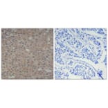 Immunohistochemistry - Smad3 (Phospho-Ser425) Antibody from Signalway Antibody (11325) - Antibodies.com