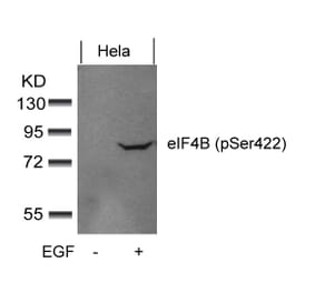 Western blot - eIF4B (phospho-Ser422) Antibody from Signalway Antibody (11513) - Antibodies.com