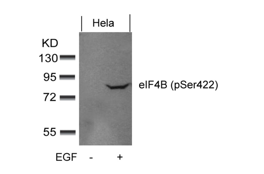 Western blot - eIF4B (phospho-Ser422) Antibody from Signalway Antibody (11513) - Antibodies.com