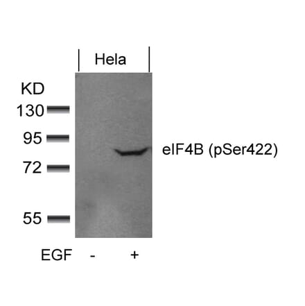 Western blot - eIF4B (phospho-Ser422) Antibody from Signalway Antibody (11513) - Antibodies.com