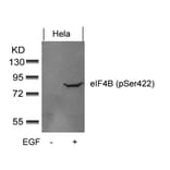 Western blot - eIF4B (phospho-Ser422) Antibody from Signalway Antibody (11513) - Antibodies.com