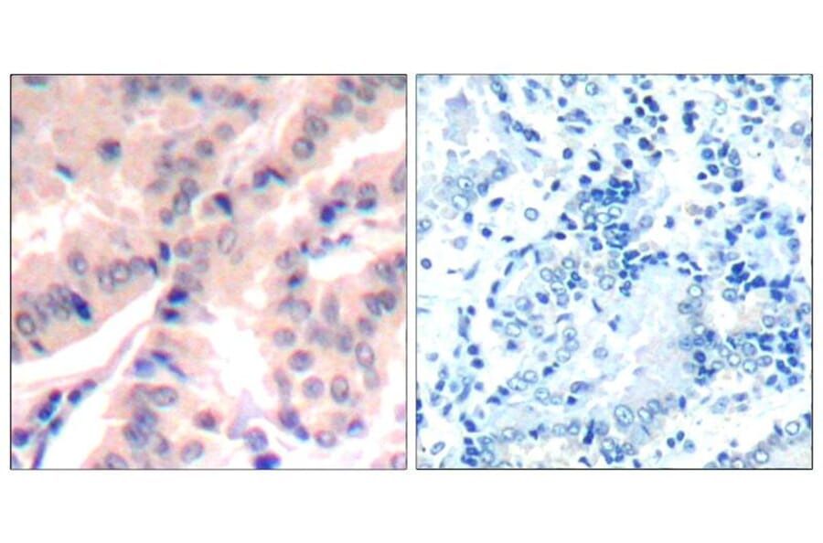 Immunohistochemistry - eIF4B (phospho-Ser422) Antibody from Signalway Antibody (11513) - Antibodies.com