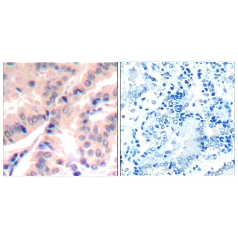 Immunohistochemistry - eIF4B (phospho-Ser422) Antibody from Signalway Antibody (11513) - Antibodies.com