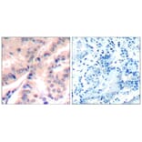 Immunohistochemistry - eIF4B (phospho-Ser422) Antibody from Signalway Antibody (11513) - Antibodies.com