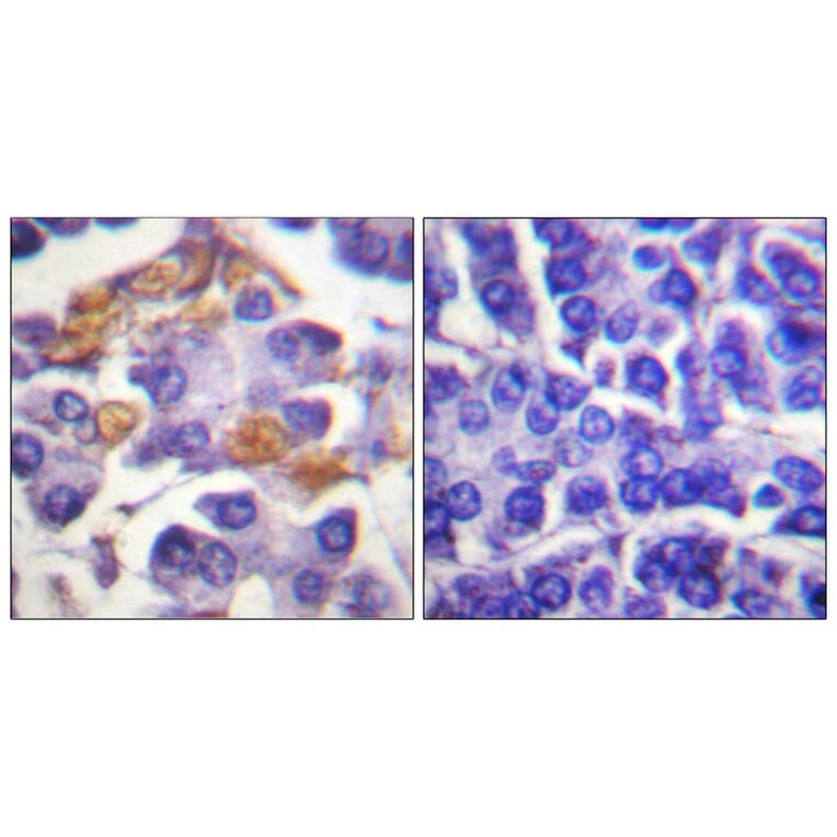Immunohistochemistry - C-RAF (Phospho-Tyr341) Antibody from Signalway Antibody (11668) - Antibodies.com