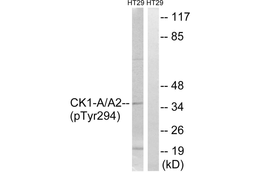 Western blot - CK-1α (Phospho-Tyr294) Antibody from Signalway Antibody (11728) - Antibodies.com