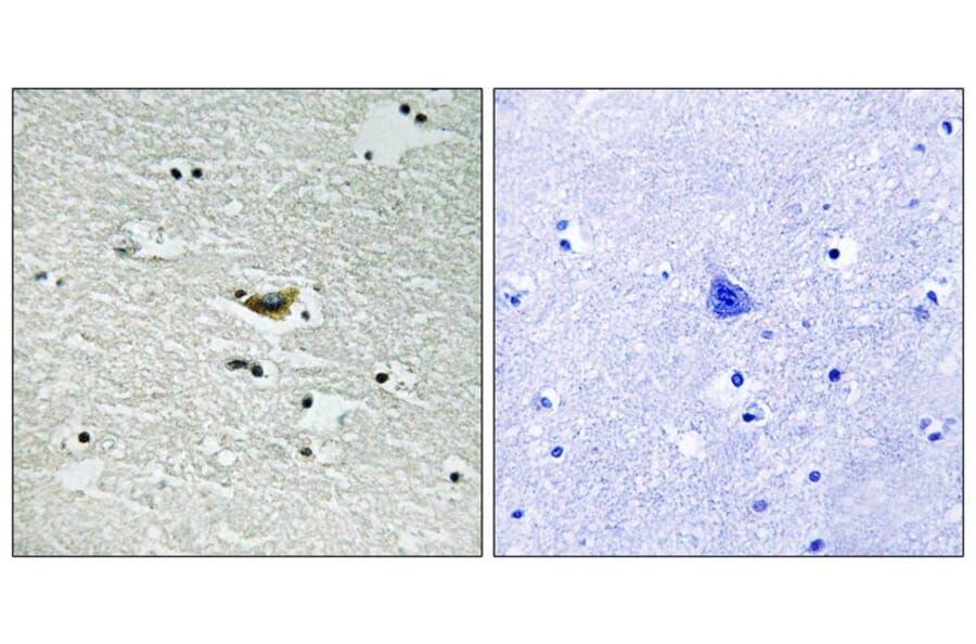 Immunohistochemistry - CK-1α (Phospho-Tyr294) Antibody from Signalway Antibody (11728) - Antibodies.com