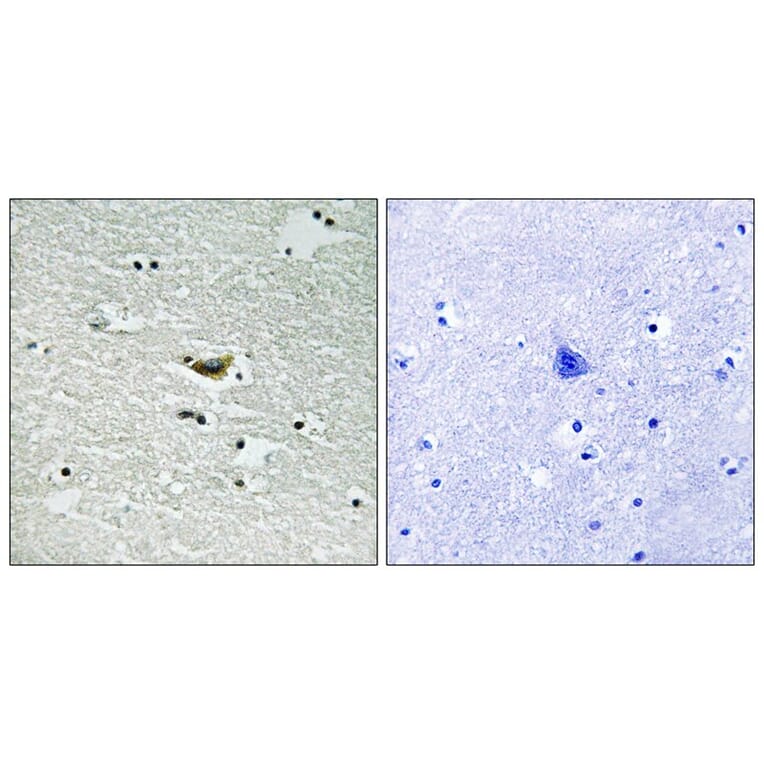 Immunohistochemistry - CK-1α (Phospho-Tyr294) Antibody from Signalway Antibody (11728) - Antibodies.com