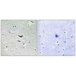 Immunohistochemistry - CK-1α (Phospho-Tyr294) Antibody from Signalway Antibody (11728) - Antibodies.com