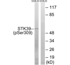 Western blot - STK39 (Phospho-Ser309) Antibody from Signalway Antibody (11755) - Antibodies.com