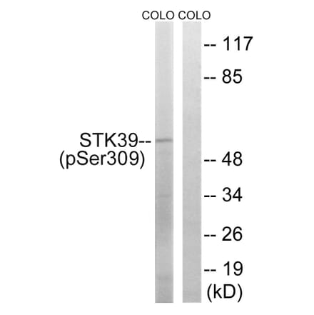 Western blot - STK39 (Phospho-Ser309) Antibody from Signalway Antibody (11755) - Antibodies.com