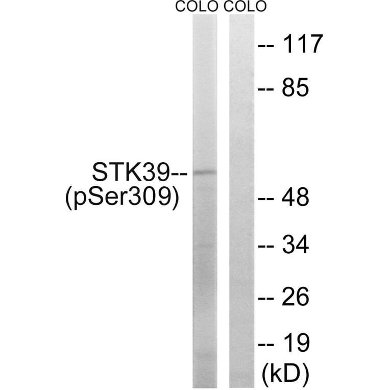 Western blot - STK39 (Phospho-Ser309) Antibody from Signalway Antibody (11755) - Antibodies.com