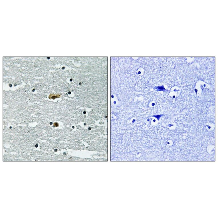 Immunohistochemistry - STK39 (Phospho-Ser309) Antibody from Signalway Antibody (11755) - Antibodies.com