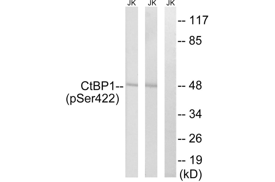 Western blot - CtBP1 (Phospho-Ser422) Antibody from Signalway Antibody (11796) - Antibodies.com