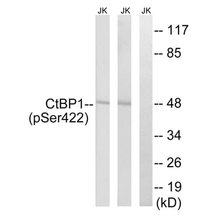 Western blot - CtBP1 (Phospho-Ser422) Antibody from Signalway Antibody (11796) - Antibodies.com