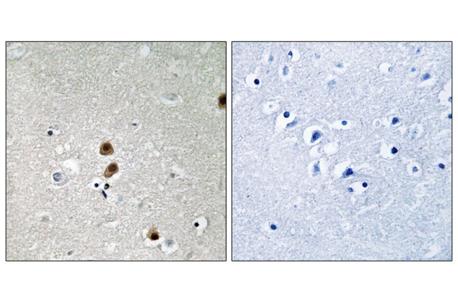 Immunohistochemistry - CtBP1 (Phospho-Ser422) Antibody from Signalway Antibody (11796) - Antibodies.com