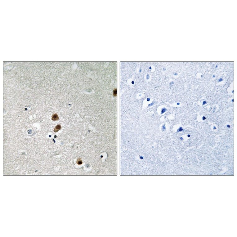 Immunohistochemistry - CtBP1 (Phospho-Ser422) Antibody from Signalway Antibody (11796) - Antibodies.com