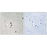 Immunohistochemistry - CtBP1 (Phospho-Ser422) Antibody from Signalway Antibody (11796) - Antibodies.com